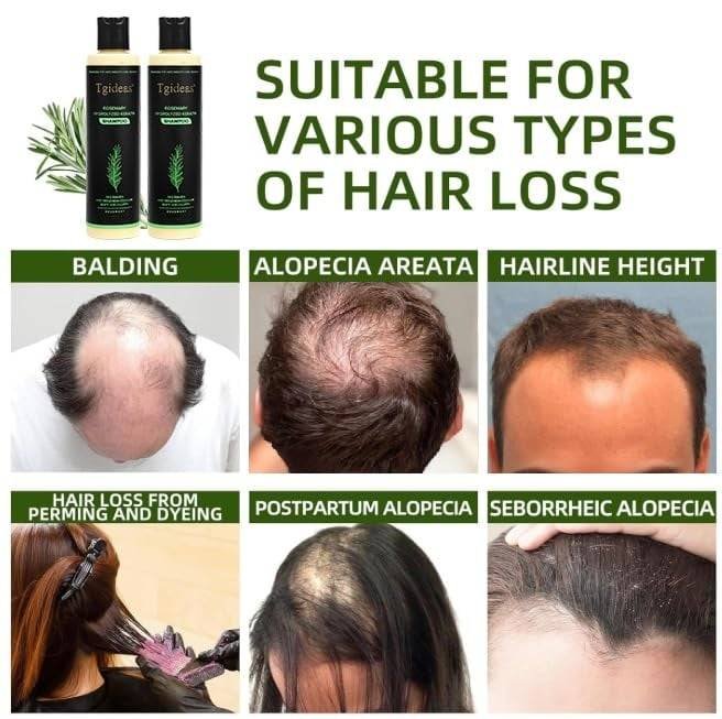 Tgideas Organic Rosemary Hair Shampoo